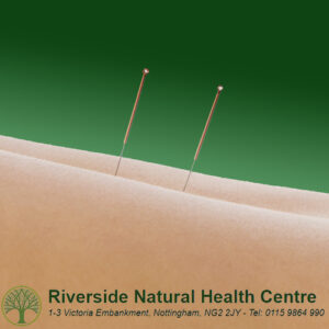Acupuncture for Male Infertility Nottingham